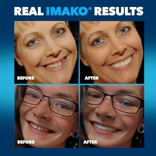 Imako Premium Cosmetic Teeth - 1 Pack - Small  Natural White - Upper Veneers - Custom Fit at Home  DIY Smile Makeover - Made in USA