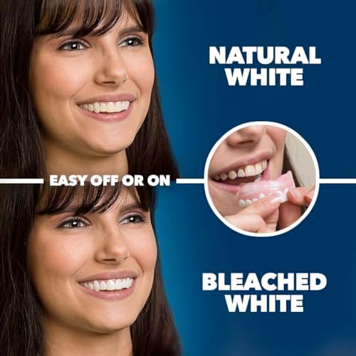 Imako Premium Cosmetic Teeth - 1 Pack - Small  Natural White - Upper Veneers - Custom Fit at Home  DIY Smile Makeover - Made in USA