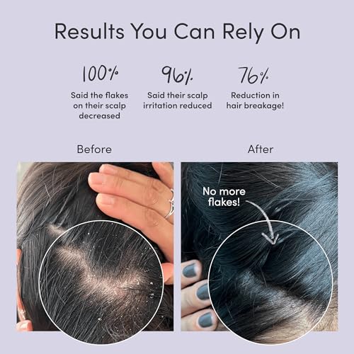 Jupiter Color Safe Dandruff Shampoo and Conditioner – Relieves Dry  Flaky  Itchy Scalp – Sulfate Free – Dry Scalp Shampoo and Conditioner – 9.5 fl oz each