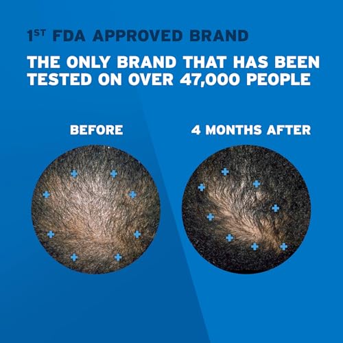 Men's Rogaine 5% Minoxidil Topical Aerosol Hair Regrowth Treatment Foam  3 Month Supply (Each Can 2.11 Ounce - 60 Gram)