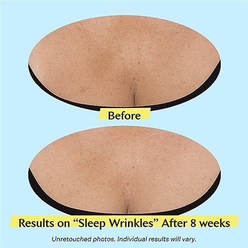 StriVectin Tighten & Lift Advanced Neck Cream PLUS with Alpha-3 Peptides™ for Neck & Décolleté  Smoothing Look of Wrinkles & Fine Lines  Improves Crepey Skin & Vertical Lines  for Soft Smooth Skin