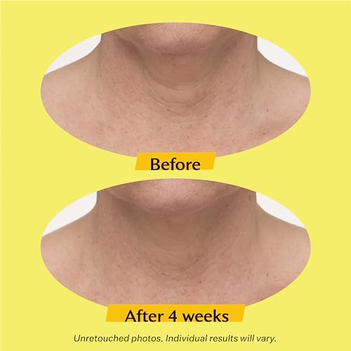 StriVectin Tighten & Lift Advanced Neck Cream PLUS with Alpha-3 Peptides™ for Neck & Décolleté  Smoothing Look of Wrinkles & Fine Lines  Improves Crepey Skin & Vertical Lines  for Soft Smooth Skin